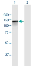 Western blot - Anti-PARG antibody (AB169639)