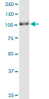 Western blot - Anti-PARG antibody (AB169639), expandable thumbnail