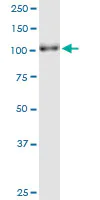 Western blot - Anti-PARG antibody (AB169639)