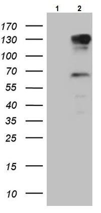 Western blot - Anti-PARG antibody [OTI1B5] (AB236403)