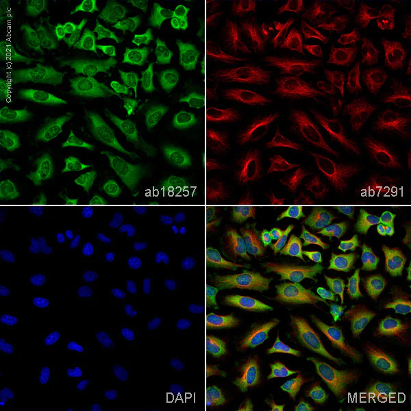 Immunocytochemistry/ Immunofluorescence - Anti-PARK7/DJ1 antibody (AB18257)