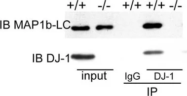 Western blot - Anti-PARK7/DJ1 antibody (AB18257)