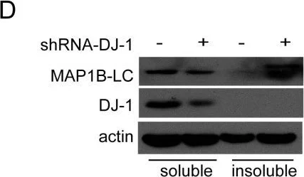 Western blot - Anti-PARK7/DJ1 antibody (AB18257)
