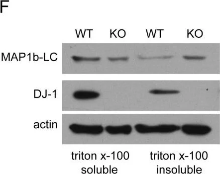 Western blot - Anti-PARK7/DJ1 antibody (AB18257)