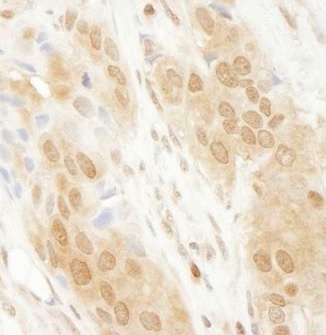 Immunohistochemistry (Formalin/PFA-fixed paraffin-embedded sections) - Anti-PARK7/DJ1 antibody (AB265596)