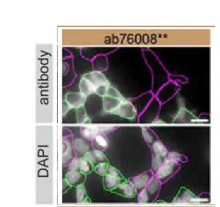 Immunocytochemistry/ Immunofluorescence - Anti-PARK7/DJ1 antibody [EP2815Y] (AB76008)