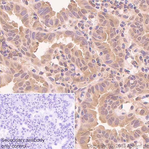 Anti-PARK7/DJ1 antibody [EP2815Y] KO tested (ab76008) | Abcam