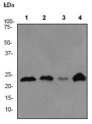Western blot - Anti-PARK7/DJ1 antibody [EP2815Y] (AB76008)