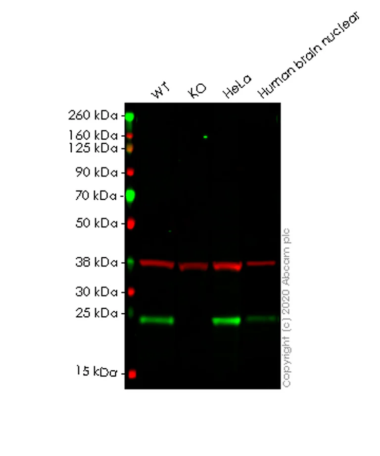 Western blot - Anti-PARK7/DJ1 antibody [EP2815Y] (AB76008)
