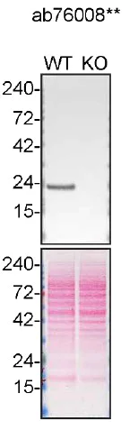 Western blot - Anti-PARK7/DJ1 antibody [EP2815Y] (AB76008)