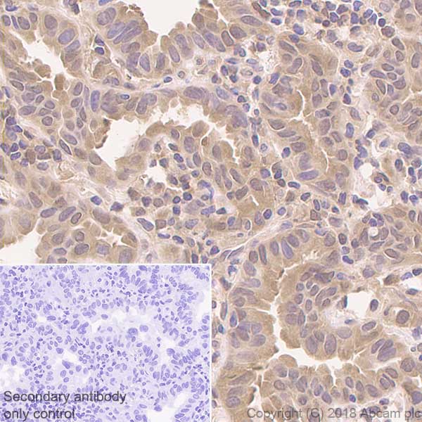 Immunohistochemistry (Formalin/PFA-fixed paraffin-embedded sections) - Anti-PARK7/DJ1 antibody [EP2815Y] - BSA and Azide free (AB218373), expandable thumbnail
