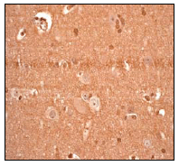 Immunohistochemistry (Formalin/PFA-fixed paraffin-embedded sections) - Anti-PARK7/DJ1 antibody [EP2815Y] - BSA and Azide free (ab218373), expandable thumbnail