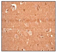 Immunohistochemistry (Formalin/PFA-fixed paraffin-embedded sections) - Anti-PARK7/DJ1 antibody [EP2815Y] - BSA and Azide free (AB218373)