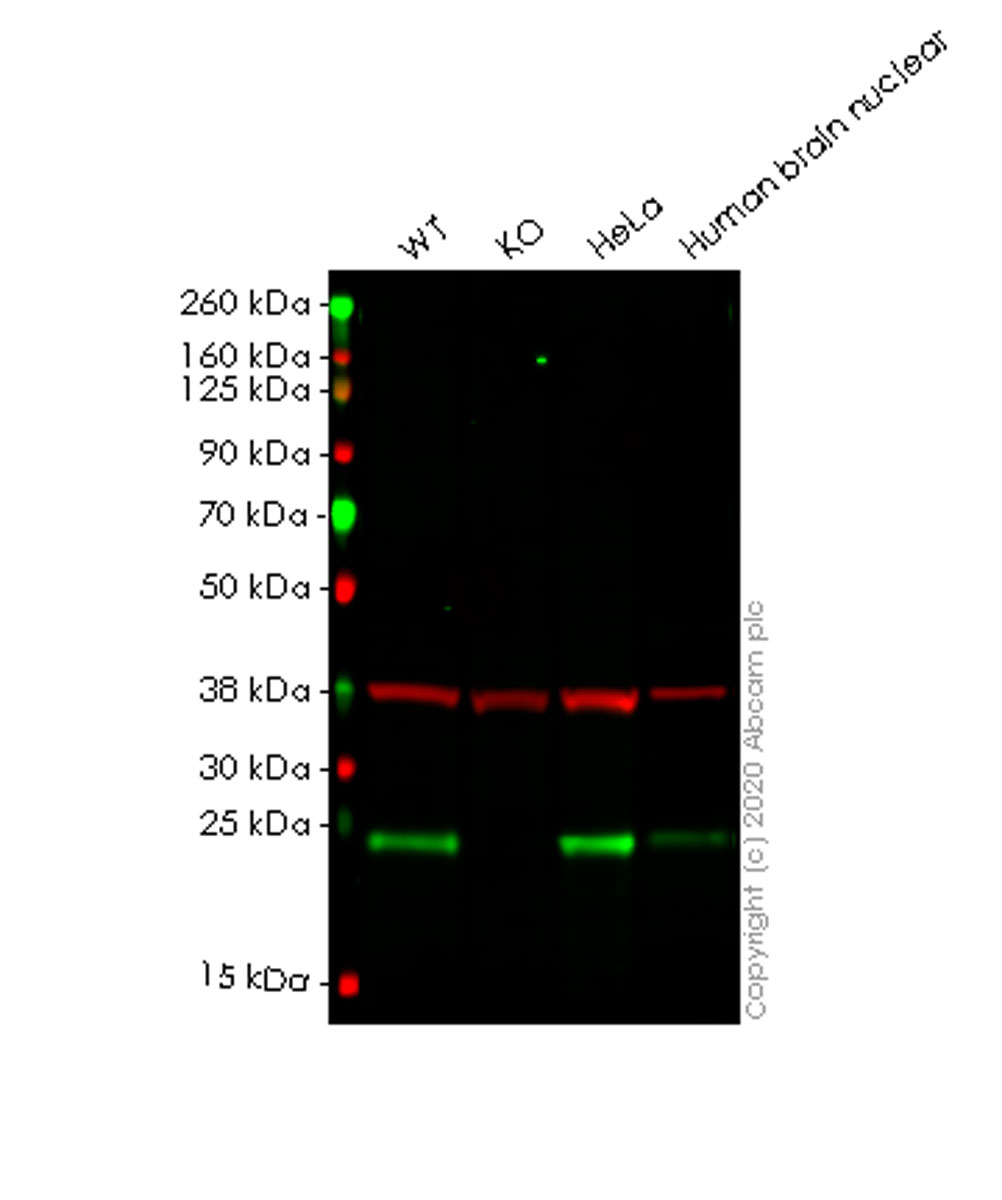 Western blot - Anti-PARK7/DJ1 antibody [EP2815Y] - BSA and Azide free (AB218373), expandable thumbnail