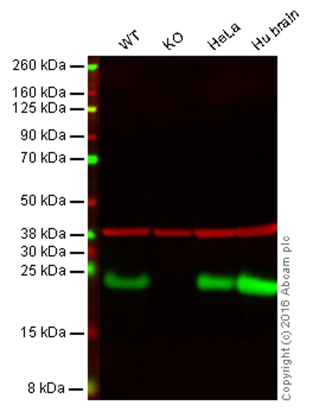 Western blot - Anti-PARK7/DJ1 antibody [EP2815Y] - BSA and Azide free (AB218373)