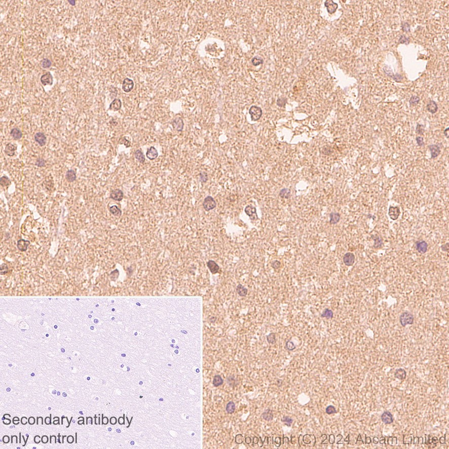 Immunohistochemistry (Formalin/PFA-fixed paraffin-embedded sections) - Anti-PARK7/DJ1 antibody [EP2816Y] (AB76241), expandable thumbnail