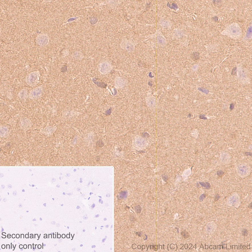 Immunohistochemistry (Formalin/PFA-fixed paraffin-embedded sections) - Anti-PARK7/DJ1 antibody [EP2816Y] (AB76241), expandable thumbnail