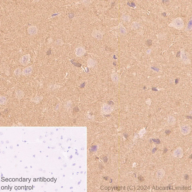Immunohistochemistry (Formalin/PFA-fixed paraffin-embedded sections) - Anti-PARK7/DJ1 antibody [EP2816Y] (AB76241)