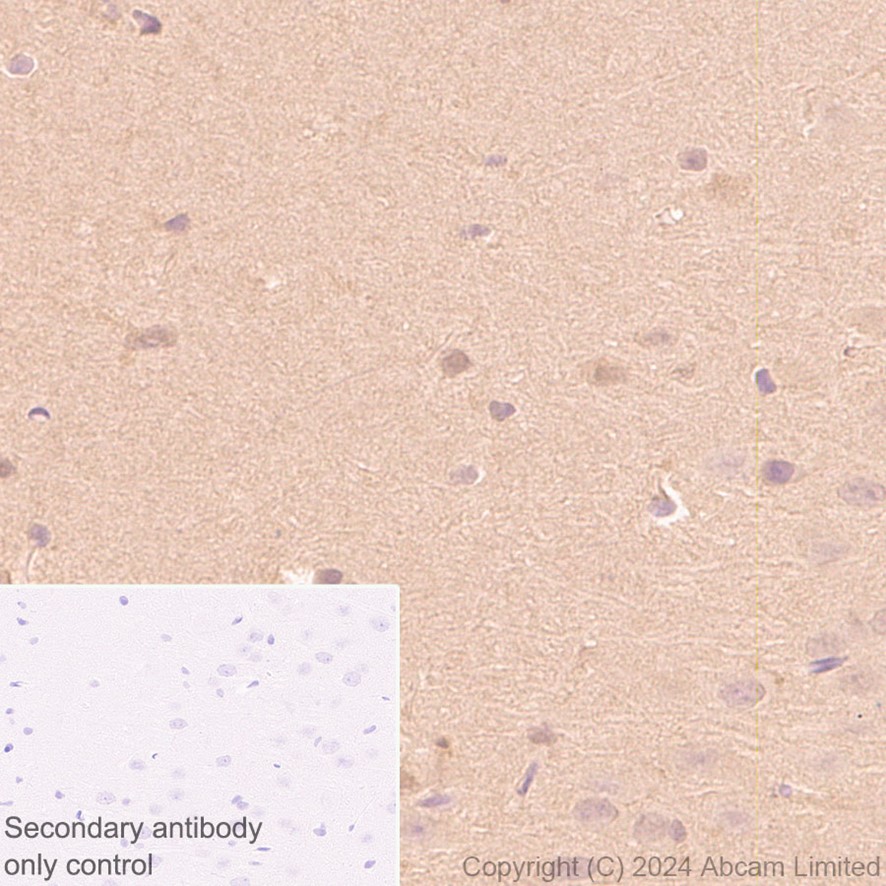 Immunohistochemistry (Formalin/PFA-fixed paraffin-embedded sections) - Anti-PARK7/DJ1 antibody [EP2816Y] (AB76241), expandable thumbnail