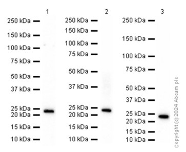 Western blot - Anti-PARK7/DJ1 antibody [EP2816Y] (AB76241), expandable thumbnail