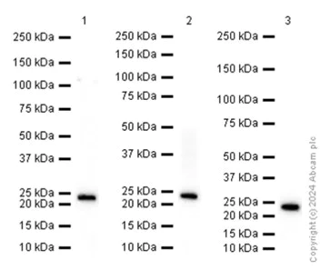 Western blot - Anti-PARK7/DJ1 antibody [EP2816Y] (AB76241)