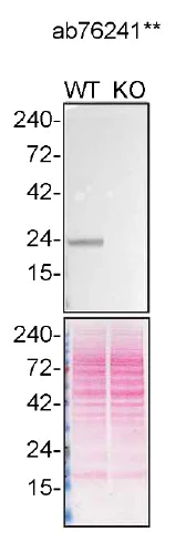 Western blot - Anti-PARK7/DJ1 antibody [EP2816Y] (AB76241)