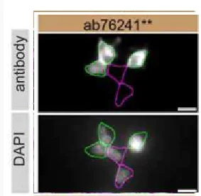 Immunocytochemistry/ Immunofluorescence - Anti-PARK7/DJ1 antibody [EP2816Y] - BSA and Azide free (AB284751)