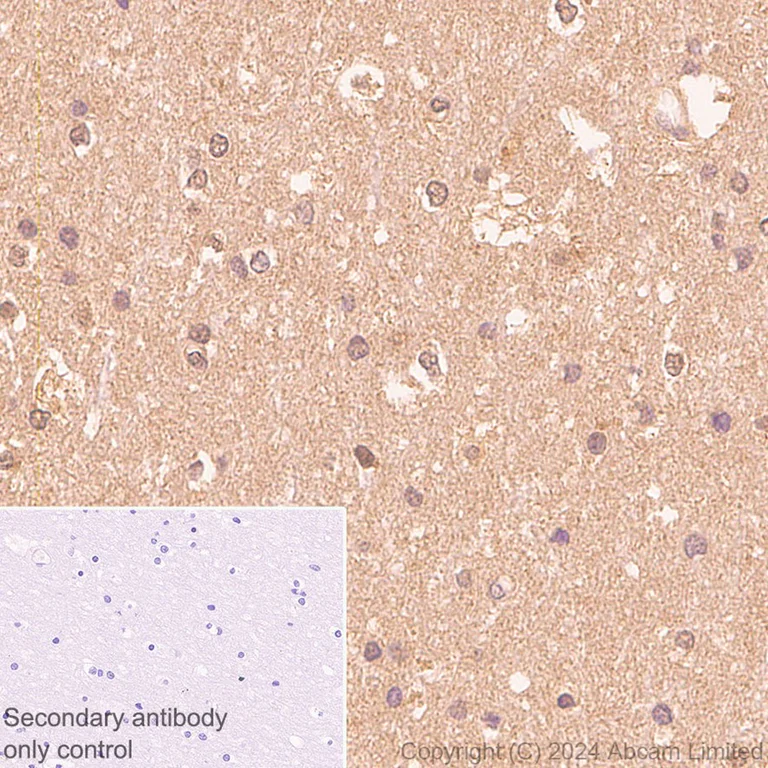 Immunohistochemistry (Formalin/PFA-fixed paraffin-embedded sections) - Anti-PARK7/DJ1 antibody [EP2816Y] - BSA and Azide free (AB284751)