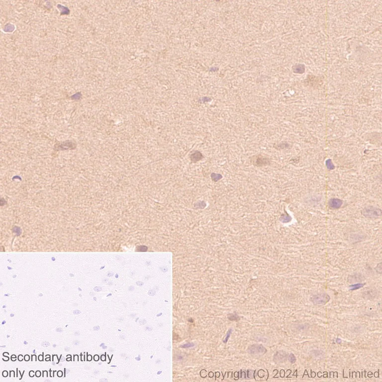 Immunohistochemistry (Formalin/PFA-fixed paraffin-embedded sections) - Anti-PARK7/DJ1 antibody [EP2816Y] - BSA and Azide free (AB284751)