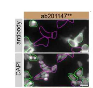 Immunocytochemistry/ Immunofluorescence - Anti-PARK7/DJ1 antibody [EPR19466-105] (AB201147)