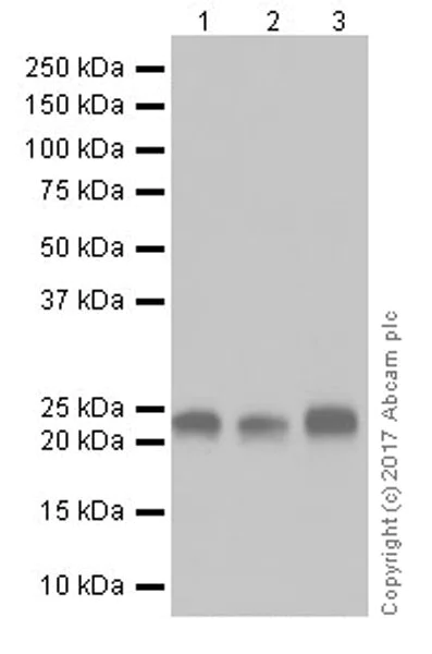 Western blot - Anti-PARK7/DJ1 antibody [EPR19466-105] (AB201147)