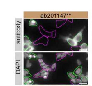 Immunocytochemistry/ Immunofluorescence - Anti-PARK7/DJ1 antibody [EPR19466-105] - BSA and Azide free (AB224529)