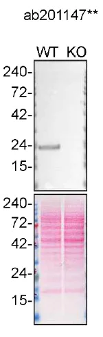 Western blot - Anti-PARK7/DJ1 antibody [EPR19466-105] - BSA and Azide free (AB224529)