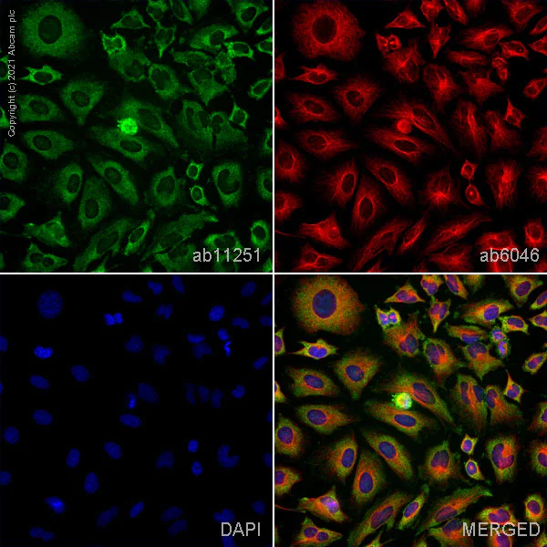 Immunocytochemistry - Anti-PARK7/DJ1 antibody [malphaDJ-1/E2.19] (AB11251)