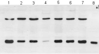 Western blot - Anti-PARK7/DJ1 antibody [malphaDJ-1/E2.19] (AB11251)