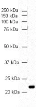 Western blot - Anti-PARK7/DJ1 antibody [malphaDJ-1/E2.19] (AB11251)