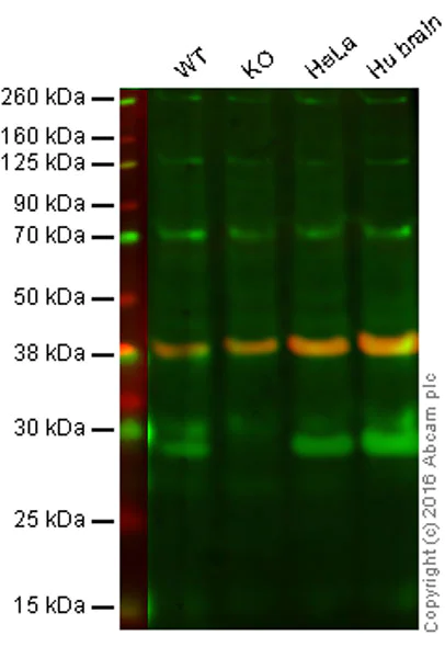 Western blot - Anti-PARK7/DJ1 antibody [malphaDJ-1/E2.19] (AB11251)