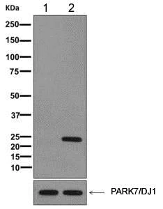 Western blot - Anti-PARK7/DJ1 antibody [MJF-R16 (66-5)] - Oxidized (AB169520)