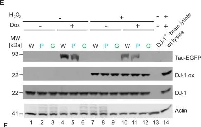 Western blot - Anti-PARK7/DJ1 antibody [MJF-R16 (66-5)] - Oxidized (AB169520)