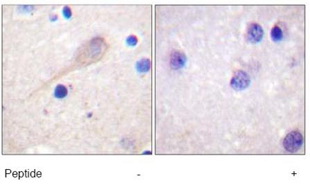 Immunohistochemistry (Formalin/PFA-fixed paraffin-embedded sections) - Anti-Parkin antibody (AB15494), expandable thumbnail