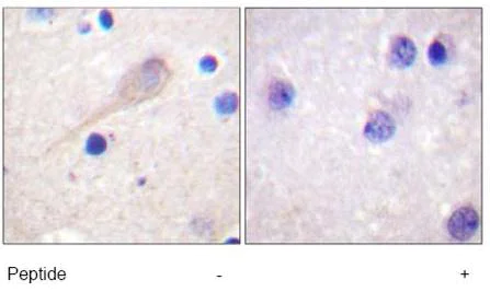 Immunohistochemistry (Formalin/PFA-fixed paraffin-embedded sections) - Anti-Parkin antibody (AB15494)