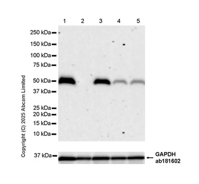 Western blot - Anti-Parkin antibody [EPR30486-673] - BSA and Azide free (AB326607)