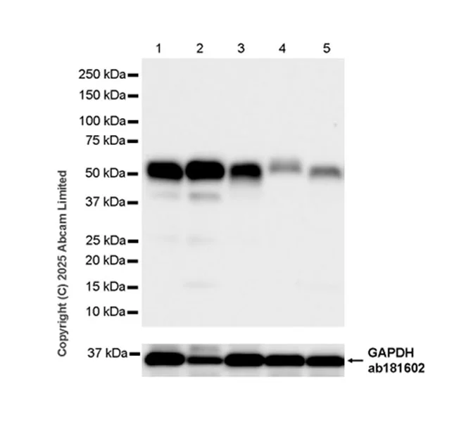 Western blot - Anti-Parkin antibody [EPR30486-673] - BSA and Azide free (AB326607)
