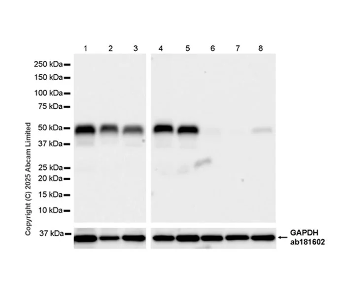 Western blot - Anti-Parkin antibody [EPR30486-673] - BSA and Azide free (AB326607)