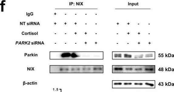 Western blot - Anti-Parkin antibody [PRK8] (AB77924)