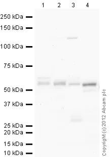 Western blot - Anti-Parkin antibody [PRK8] - BSA and Azide free (AB264105)