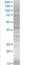Parkin overexpression 293T lysate (whole cell)
