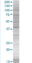 SDS-PAGE - Parkin overexpression 293T lysate (whole cell) (AB94077)
