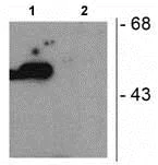 Western blot - Anti-Parkin (phospho S101) antibody (AB73015)