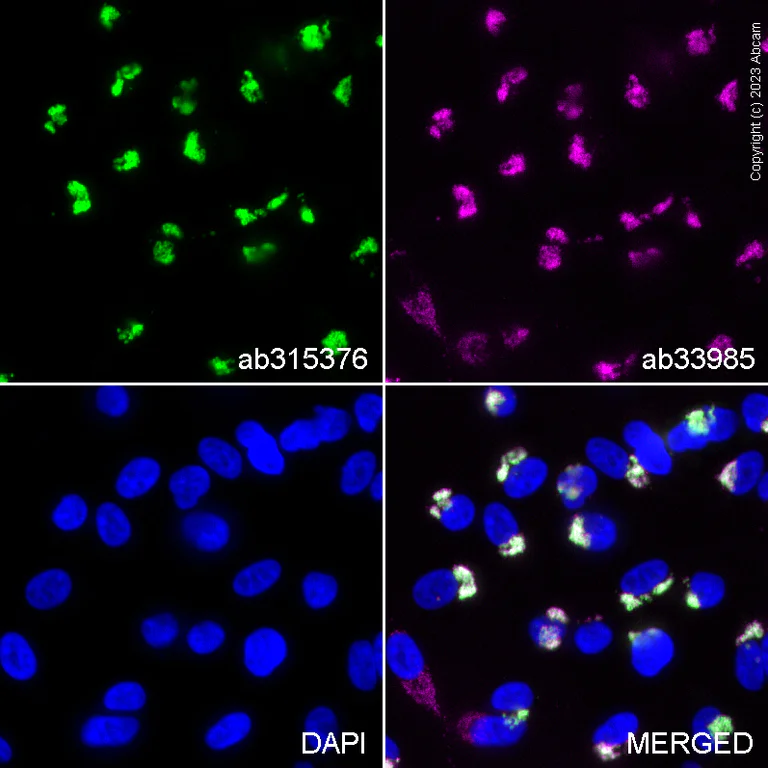 Immunocytochemistry/ Immunofluorescence - Anti-Parkin (phospho S65) antibody [MJF-R17-42-4] (AB315376)